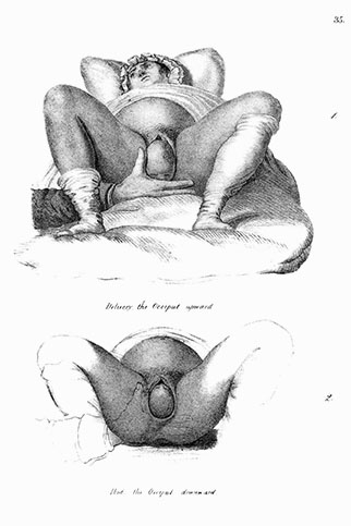 Midwifery Illustrated, click for larger image