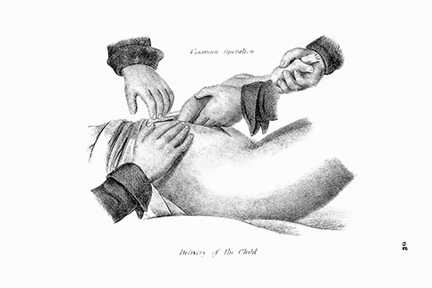 Midwifery Illustrated, click for larger image