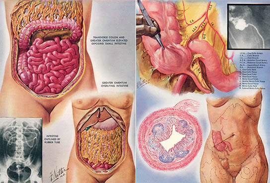 Small Intestine, click for larger image