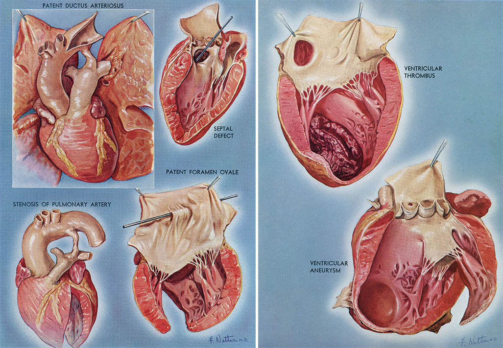 [Extra Quality] Netter Interactive Atlas Of Human Anatomy 30iso