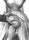 Midwifery Illustrated